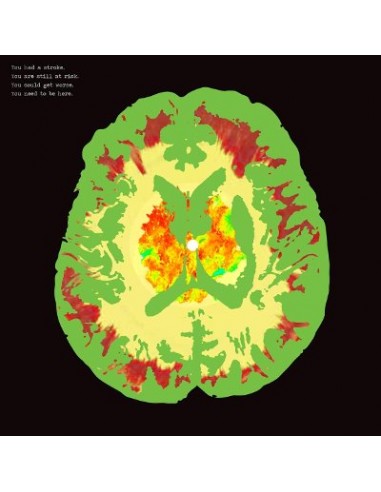 Minus 5 : Stroke Manor (LP) RSD